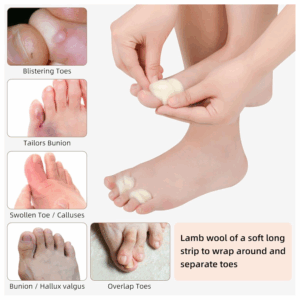 Carnation Footcare Animal Wool 25g - Image 4