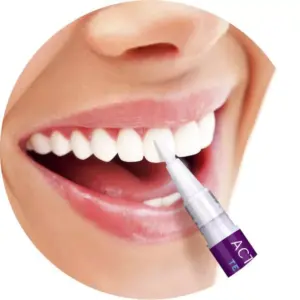 Wisdom Teeth Active Whitening Pen - Image 3