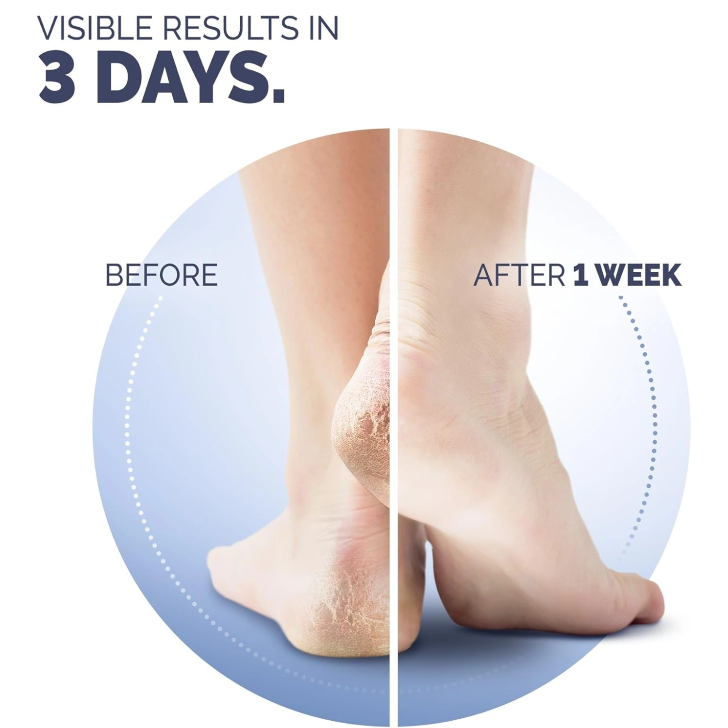 Scholl cracked heel skin repair balm cream 60ml 6