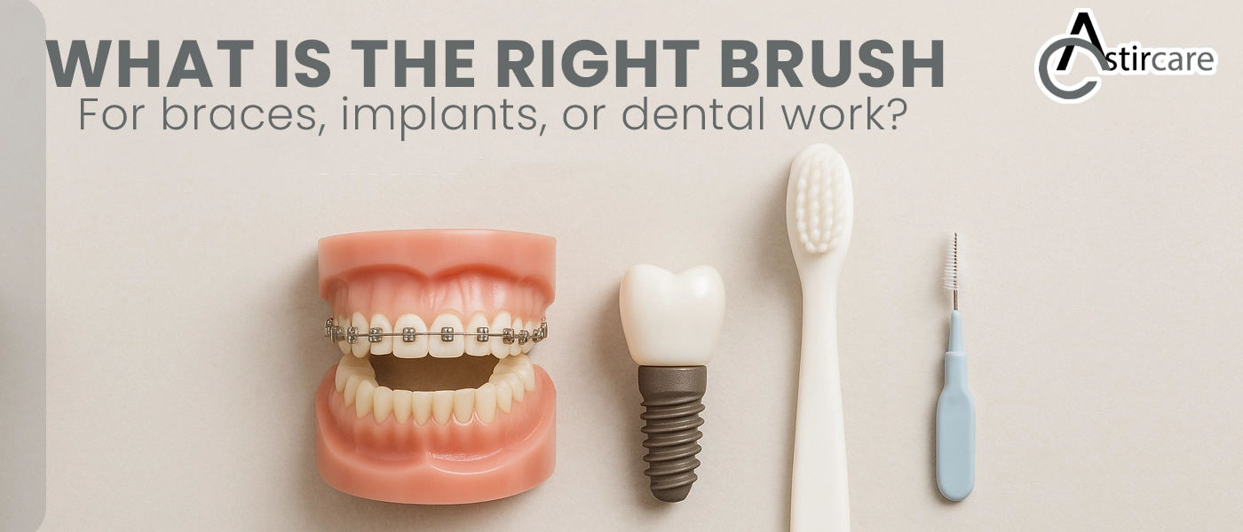 What is the right brush for braces, implants, or dental work